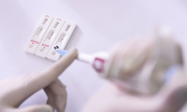ASES ordena cubierta de pruebas de VIH periódicas