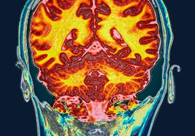 Científicos confirman cambios en regiones del cerebro durante el ciclo menstrual
