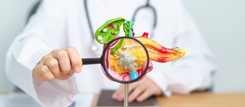 El cáncer de páncreas suele detectarse en etapas avanzadas debido a la ausencia de síntomas tempranos.