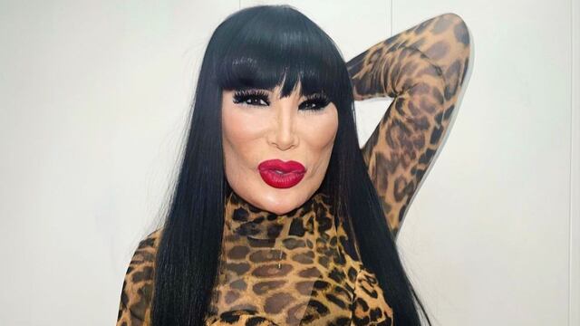 Lyn May confiesa que le inyectaron aceite en su rostro