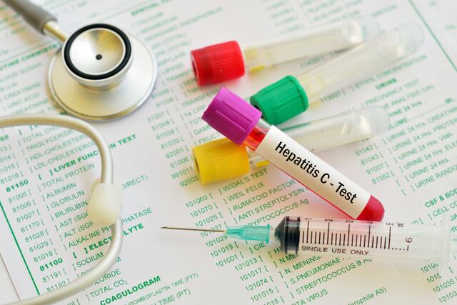 Difícil alcanzar meta de Salud para erradicar hepatitis en cinco años