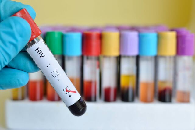 Instan a realizarse prueba del VIH