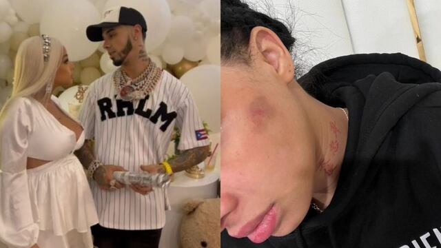 Yailín “La más viral” acusa a Anuel AA de golpearla mientras estaba embarazada