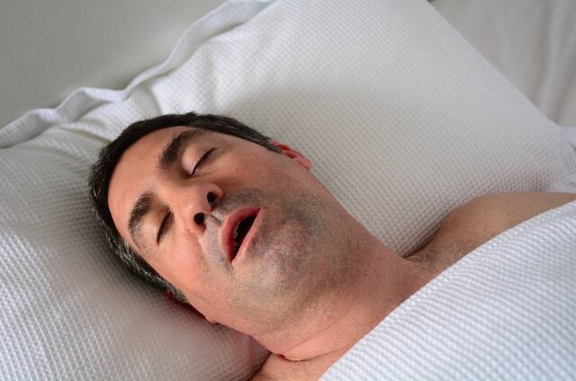 Qué es la apnea obstructiva del sueño (SAOS)
