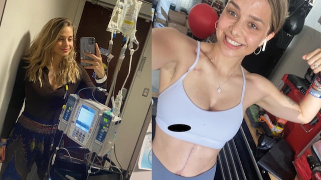 Joven que tenía demasiados gases fue al médico y recibió devastador diagnóstico