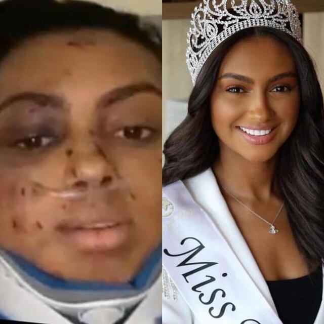 Candidata de Miss Mundo 2023 sufre aparatoso accidente de auto