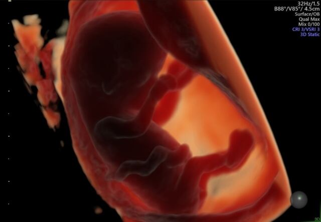 Alimentos ultraprocesados podrían afectar la fertilidad y el desarrollo del feto, según estudio