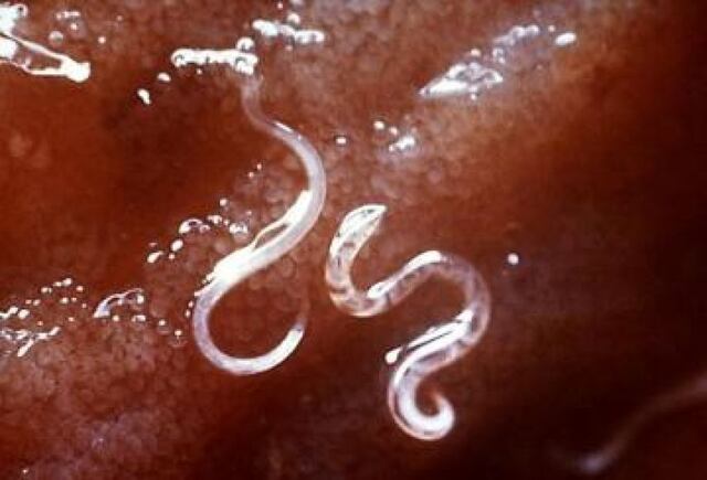 Lombrices intestinales comparten material genético con humanos (crónica)
