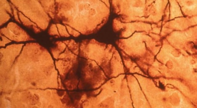 Descubren nuevo órgano sensorial en el cuerpo humano