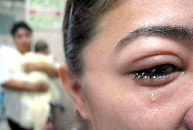 Constatan en este y norte de P.R. aumento casos de conjuntivitis