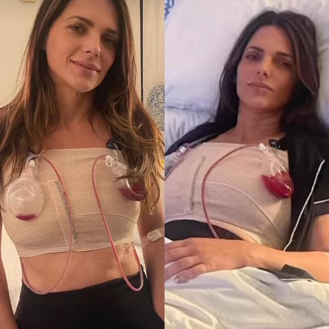Bárbara Bermudo publica desgarrador vídeo tras padecer enfermedad de los implantes mamarios