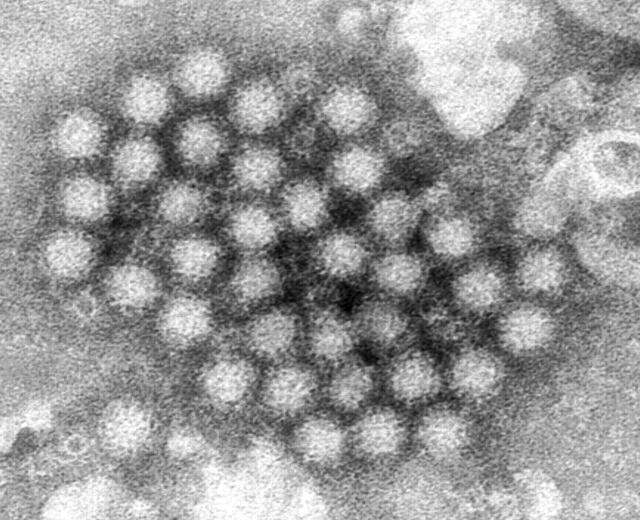 Aumentan los casos de norovirus en Estados Unidos