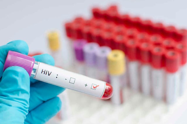 Preocupa cambio que afectará provisión de medicamentos a personas que viven con VIH