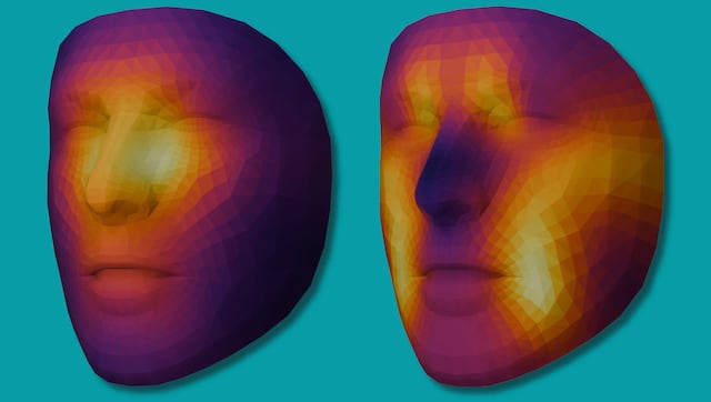 Reconocimiento facial con IA podría ayudar a personalizar tratamientos contra el cáncer
