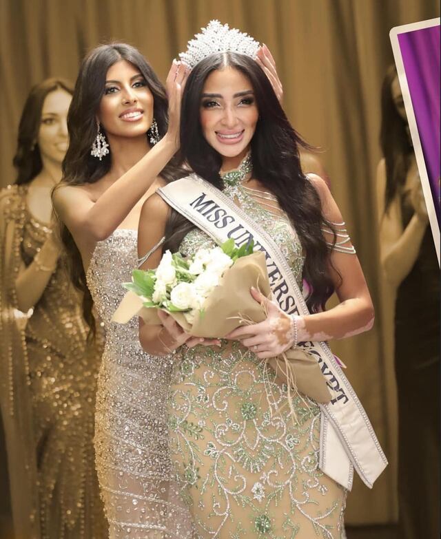 Madre con vitiligo representará a Egipto en Miss Universo 2024