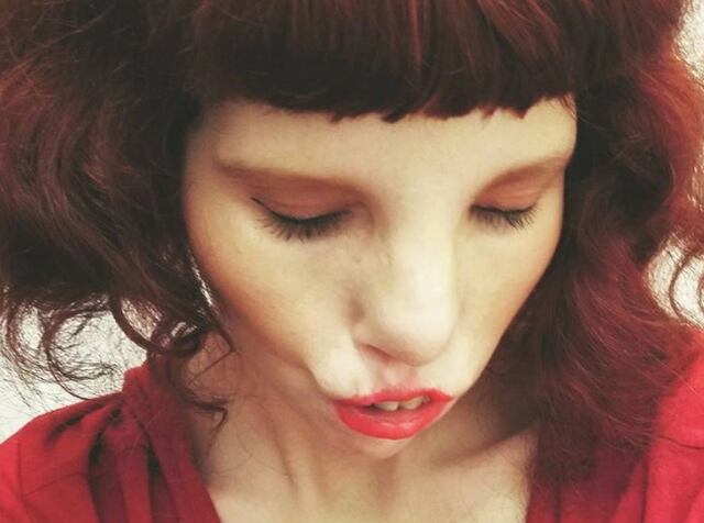 La mujer con el extrañísimo “síndrome de ojos de gato” que cautiva en Instagram