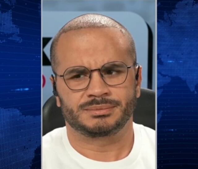 Jay Fonseca se realiza tratamiento para crecer su cabello