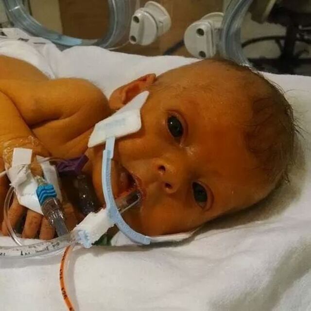 Usan Photoshop para ayudar a padre a superar muerte de hija
