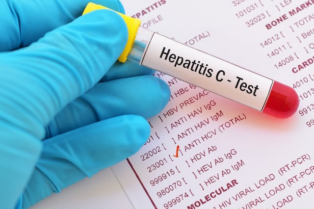 Accesibles y efectivos los tratamientos contra la hepatitis