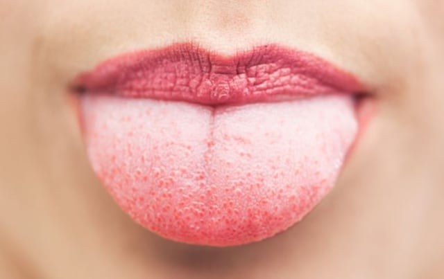 Conoce cómo la lengua puede revelar problemas de salud