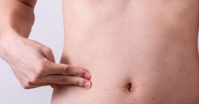 ¿Por qué el cáncer de apéndice aumenta en los jóvenes?