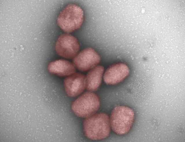 OMS confirma transmisión sexual de viruela símica en el Congo