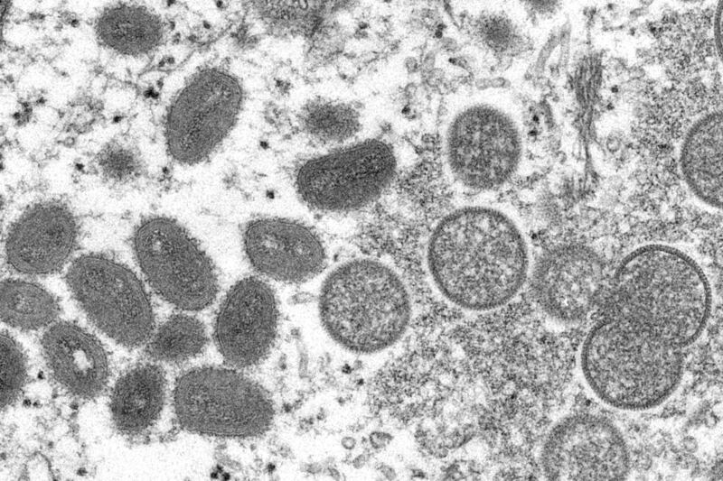Foto: Cynthia S. Goldsmith, Russell Regner/CDC via AP.