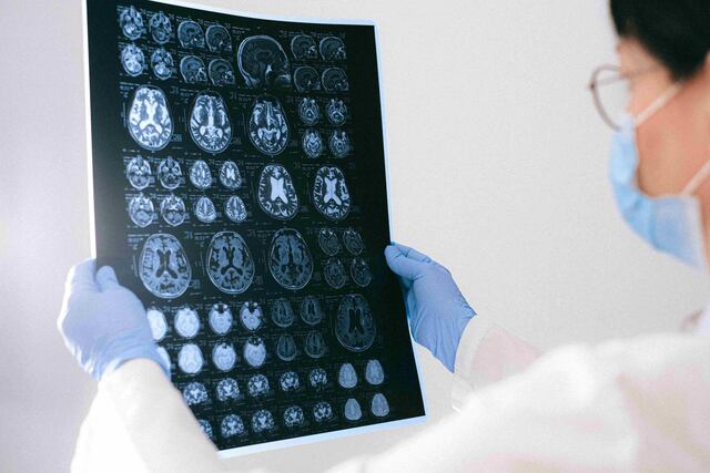 Buscan mejorar los servicios para pacientes con epilepsia en Puerto Rico