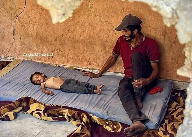 El hambre mata a más de cien personas en Gaza. La mayoría son niños.