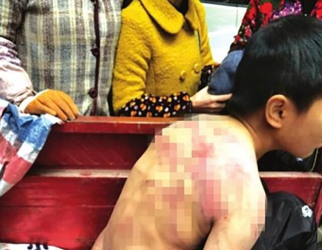 Menor de 10 años dormía desnudo en la vía pública y con -2 grados de temperatura por temor a sus padres: le propinaban violentos latigazos