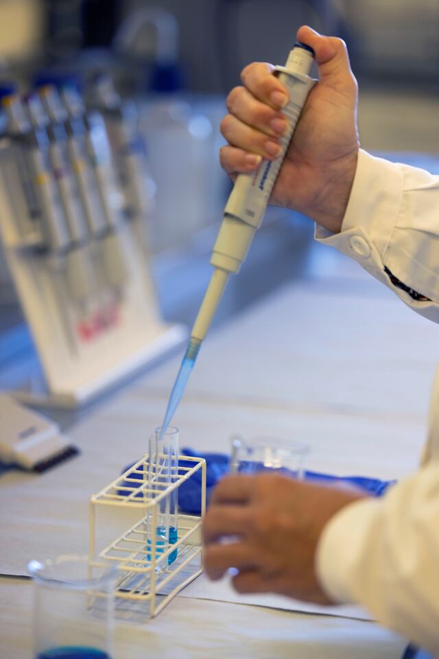 Estudio avala la sospecha: virus de Epstein-Barr puede causar la esclerosis múltiple