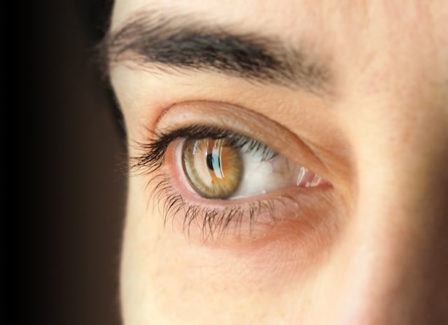 5 puntos clave en la batalla contra el glaucoma