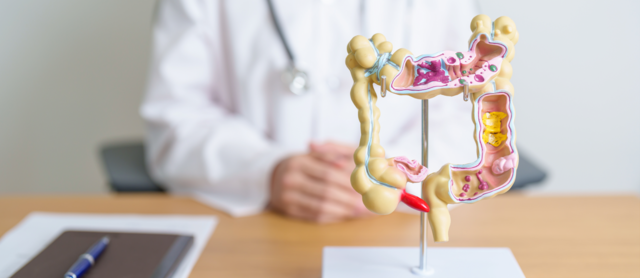 Cáncer Colorrectal: Una condición común pero poco conocido