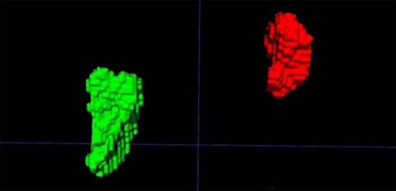 Gracias a un modelo de inteligencia artificial, investigadores han identificado un nuevo biomarcador visible en imágenes médicas de rutina que permite detectar el estrés crónico. Foto: Elena Ghotbi.