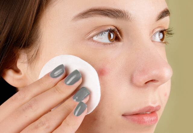 Dermatologa se hace viral al explicar como una rutina de cepillado causa acné