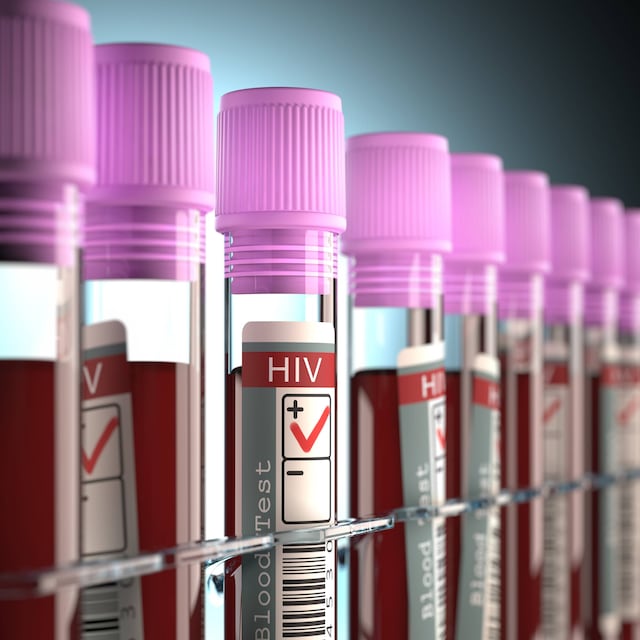 Sobre 3,000 personas pueden estar expuestas al virus del VIH y a hepatitis