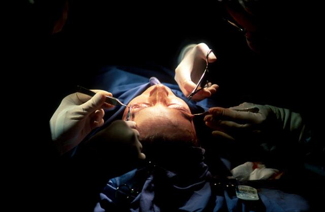 Alertan sobre médicos sin entrenamiento en cirugía plástica que practican procedimientos quirúrgicos estéticos