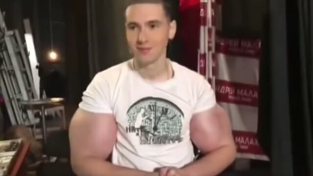 'Hulk ruso' se inyecta mezcla casera para no volver a trabajar