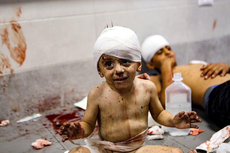 Niños palestinos heridos en el hospital al-Shifa en Gaza.