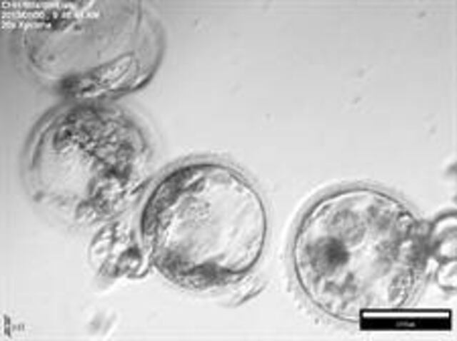 Investigadores logran modificar genéticamente embriones humanos