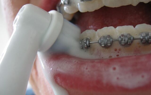 Estudio advierte sobre diversidad de virus en los cepillos de dientes