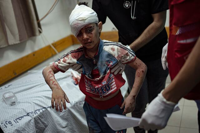 Poca luz, sin camas, sin anestesia suficiente; médico describe “una pesadilla” en hospitales de Gaza