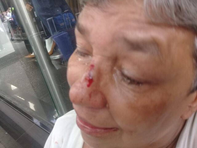 Cobrador golpeó en la cara a una abuelita que le debía $30,000 pesos colombianos
