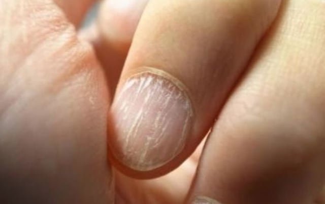 El terrible hábito que debes evitar para no arruinar tus uñas