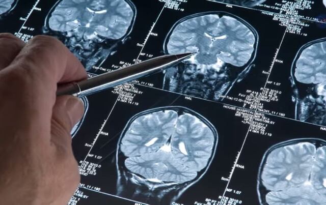 Estudiarán enfermedad de Alzheimer en el espacio