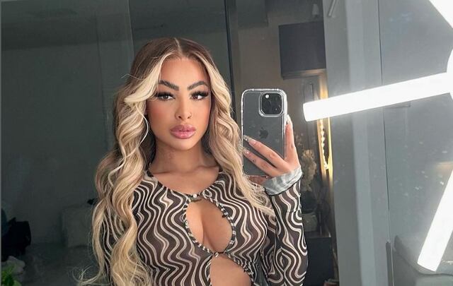 Yailin La Más Viral reacciona a foto donde sale con el rostro golpeado