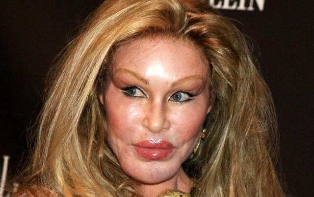 Fallece Jocelyn Wildenstein, mejor conocida por su apodo “Catwoman”