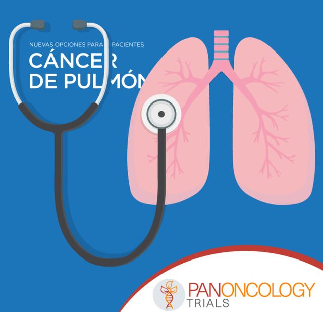 Panoncology Trials ofrece nuevas opciones para  pacientes de Cáncer de Pulmón