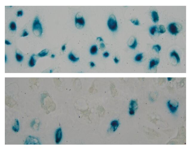 Descubren que un compuesto derivado de la anémona del mar Caribe podría mejorar el tratamiento contra el cáncer