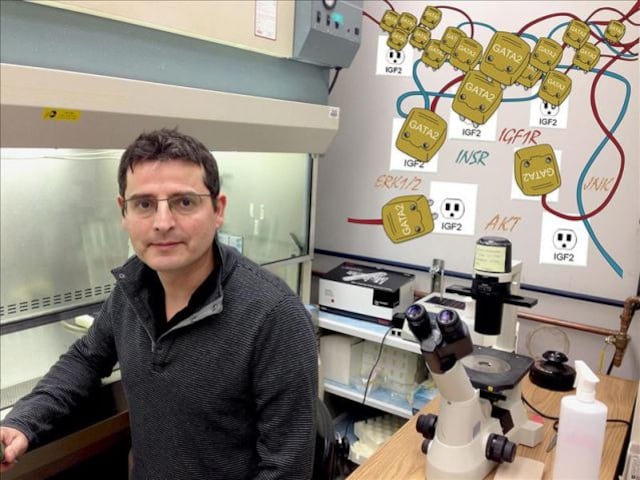 Localizan gen que activa agresividad en cáncer de próstata